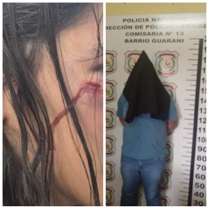 Hombre hiere a su hijastra de 15 años con una lata de cerveza en Pedro Juan Caballero