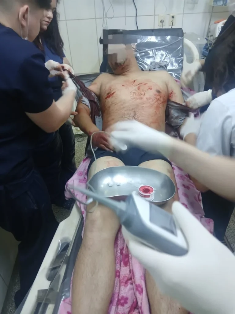 Un hombre es apuñalado tras el ataque de la ex pareja de una mujer en PJC