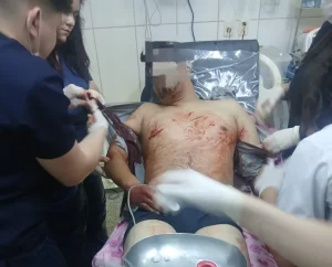 Un hombre es apuñalado tras el ataque de la ex pareja de una mujer en PJC