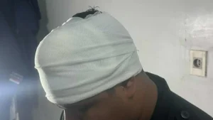 Policía recibe machetazo en la cabeza en intervención por violencia familiar en Luque